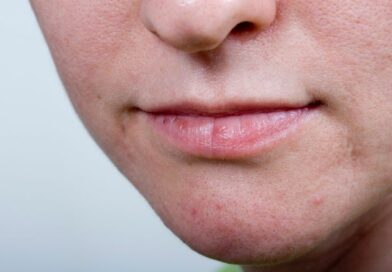 وصفة لإزالة الحبوب من الوجه في يوم واحد